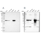Western blot analysis using Anti-ACAA1 antibody HPA006764 (A) shows similar pattern to independent antibody HPA007244 (B).