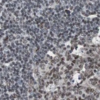 Immunohistochemical staining of human lymph node using Anti-ZHX2 antibody HPA006769.