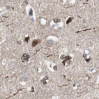 Immunohistochemical staining of human cerebral cortex using Anti-ZHX2 antibody HPA006769.