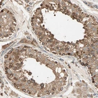 Immunohistochemical staining of human testis shows moderate cytoplasmic positivity in cells in seminiferous ducts.