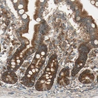 Immunohistochemical staining of human gastrointestinal shows moderate to strong cytoplasmic positivity in glandular cells.