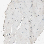 Immunohistochemical staining of human skeletal muscle shows no positivity in myocytes.