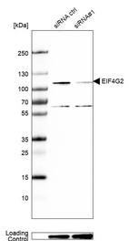 Western blot analysis in A-431 cells transfected with control siRNA, target specific siRNA probe #1, using Anti-EIF4G2 antibody. Remaining relative intensity is presented. Loading control: Anti-GAPDH.