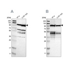 Western blot analysis using Anti-EIF4G2 antibody HPA006773 (A) shows similar pattern to independent antibody HPA016965 (B).