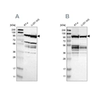 Western blot analysis using Anti-EIF4G2 antibody HPA006773 (A) shows similar pattern to independent antibody HPA016965 (B).
