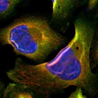 Immunofluorescent staining of human cell line U-2 OS shows positivity in cytoplasm.