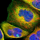 Immunofluorescent staining of human cell line A-431 shows localization to plasma membrane & cytosol.