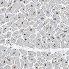 Immunohistochemical staining of human heart muscle shows strong nuclear positivity in cardiomyocytes.