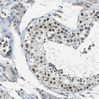 Immunohistochemical staining of human testis shows weak nuclear positivity in cells in seminiferous ducts.