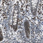 Immunohistochemical staining of human rectum shows moderate nuclear positivity in glandular cells.
