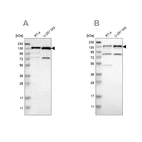 Western blot analysis using Anti-USP28 antibody HPA006778 (A) shows similar pattern to independent antibody HPA006779 (B).