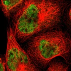 Immunofluorescent staining of human cell line A-431 shows localization to nucleoplasm.