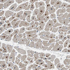 Immunohistochemical staining of human heart muscle shows strong nuclear positivity in cardiomyocytes.