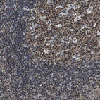 Immunohistochemical staining of human lymph node shows strong nuclear positivity in germinal center cells.