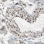 Immunohistochemical staining of human testis shows moderate nuclear positivity in cells in seminiferous ducts.