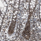 Immunohistochemical staining of human rectum shows strong nuclear positivity in glandular cells.