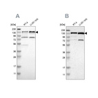 Western blot analysis using Anti-USP28 antibody HPA006779 (A) shows similar pattern to independent antibody HPA006778 (B).