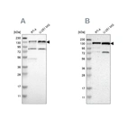 Western blot analysis using Anti-USP28 antibody HPA006779 (A) shows similar pattern to independent antibody HPA006778 (B).
