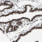 Immunohistochemical staining of human fallopian tube shows strong nuclear positivity in glandular cells.