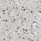 Immunohistochemical staining of human cerebral cortex shows strong nuclear positivity in neuronal cells.