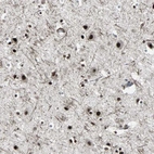 Immunohistochemical staining of human cerebral cortex shows strong nuclear positivity in neuronal cells.