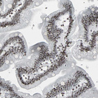 Immunohistochemical staining of human duodenum shows moderate nuclear positivity in glandular cells.
