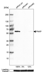 Anti-PNKP Antibody