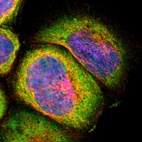 Immunofluorescent staining of human cell line A-431 shows localization to cytosol.