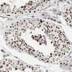 Immunohistochemical staining of human testis shows strong nuclear positivity in cells in seminiferous ducts.