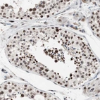 Immunohistochemical staining of human testis shows strong nuclear positivity in cells in seminiferous ducts.