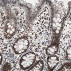 Immunohistochemical staining of human rectum shows strong nuclear positivity in glandular cells.