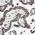 Immunohistochemical staining of human placenta shows strong nuclear positivity in trophoblastic cells.