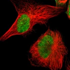 Immunofluorescent staining of human cell line U-251 MG shows localization to nucleoplasm.