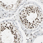 Anti-XRCC4 Antibody