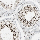 Immunohistochemical staining of human testis shows strong nuclear positivity in cells in seminiferous ducts.