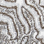 Immunohistochemical staining of human small intestine shows strong nuclear positivity in glandular cells.