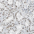 Immunohistochemical staining of human kidney shows moderate nuclear positivity in cells in tubules.