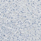 Immunohistochemical staining of human liver shows no positivity in hepatocytes as expected.