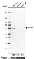 Western blot analysis in Rh30 cells transfected with control siRNA, target specific siRNA probe #1 and #2, using Anti-XRCC4 antibody. Remaining relative intensity is presented. Loading control: Anti-GAPDH.
