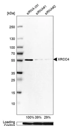 Western blot analysis in Rh30 cells transfected with control siRNA, target specific siRNA probe #1 and #2, using Anti-XRCC4 antibody. Remaining relative intensity is presented. Loading control: Anti-GAPDH.