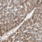 Anti-HPN Antibody