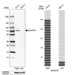 Western blot analysis in human cell lines A-431 and MCF-7 using Anti-SWAP70 antibody. Corresponding SWAP70 RNA-seq data are presented for the same cell lines. Loading control: Anti-PPIB.