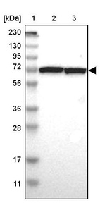 Lane 1: Marker [kDa] 230, 130, 95, 72, 56, 36, 28, 17, 11_br/_Lane 2: Human cell line RT-4_br/_Lane 3: Human cell line U-251MG sp