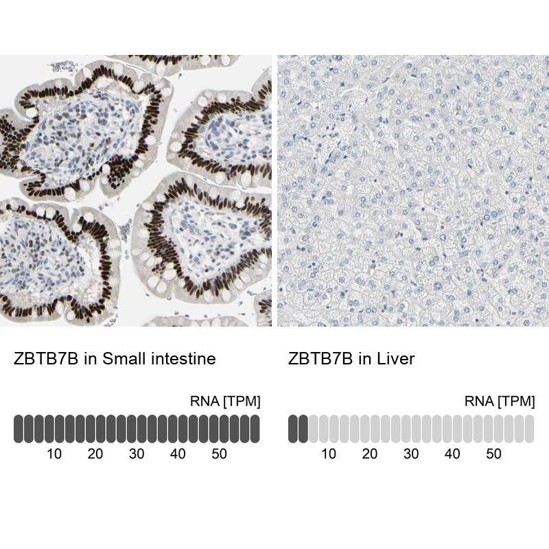 Anti-ZBTB7B Antibody