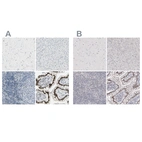 Immunohistochemical staining of human cerebral cortex, liver, lymph node and small intestine using Anti-ZBTB7B antibody HPA006811 (A) shows similar protein distribution across tissues to independent antibody HPA025820 (B).