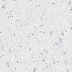 Immunohistochemical staining of human cerebral cortex shows no positivity in neurons as expected.