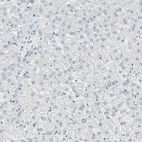 Immunohistochemical staining of human liver shows no positivity in hepatocytes as expected.