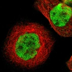 Immunofluorescent staining of human cell line A-431 shows localization to nucleoplasm.