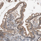 Anti-SMG1 Antibody