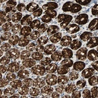Anti-CMC2 Antibody